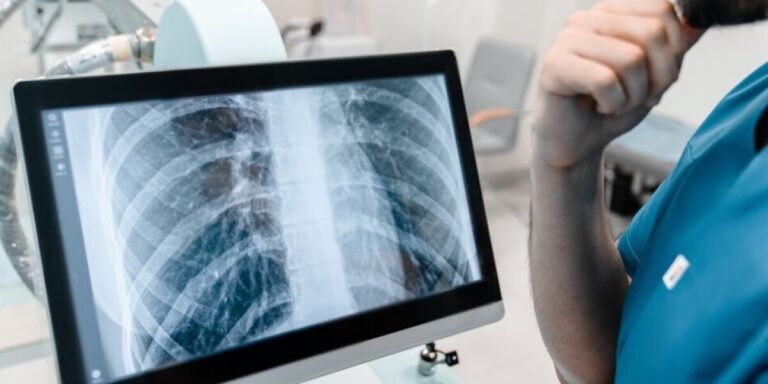 Un cas de tuberculose en France incite au dépistage des contacts